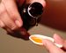 ເດັກນ້ອຍອິນໂດເນເຊຍເສຍຊີວິດຈາກ “ອາການໝາກໄຂ່ຫລັງລົ້ມເຫລວ” ເກີນ 130 ຄົນແລ້ວໃນປີນີ້