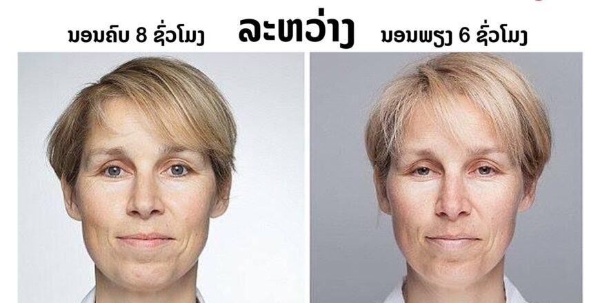 ມາເບິ່ງຄວາມແຕກຕ່າງໃບໜ້າທີ່ເປັນຜົນມາຈາກການນອນ ມາເບິ່ງຄວາມແຕກຕ່າງໃບໜ້າທີ່ເປັນຜົນມາຈາກການນອນ