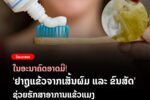 ໃນອະນາຄົດຈະມີ ຢາຖູແຂ້ວຈາກເສັ້ນຜົມ ຊ່ວຍຫລຸດອາການແຂ້ວແມງ