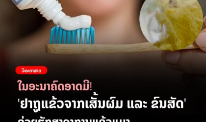 ໃນອະນາຄົດຈະມີ ຢາຖູແຂ້ວຈາກເສັ້ນຜົມ ຊ່ວຍຫລຸດອາການແຂ້ວແມງ