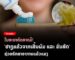 ໃນອະນາຄົດຈະມີ ຢາຖູແຂ້ວຈາກເສັ້ນຜົມ ຊ່ວຍຫລຸດອາການແຂ້ວແມງ