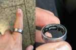 ເກືອບໄດ້ຕັດນິ້ວ! Galaxy Ring ແບັດບວມຕິດນິ້ວ ຕ້ອງຮີບເຂົ້າຫ້ອງສຸກເສີນ