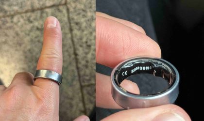 ເກືອບໄດ້ຕັດນິ້ວ! Galaxy Ring ແບັດບວມຕິດນິ້ວ ຕ້ອງຮີບເຂົ້າຫ້ອງສຸກເສີນ