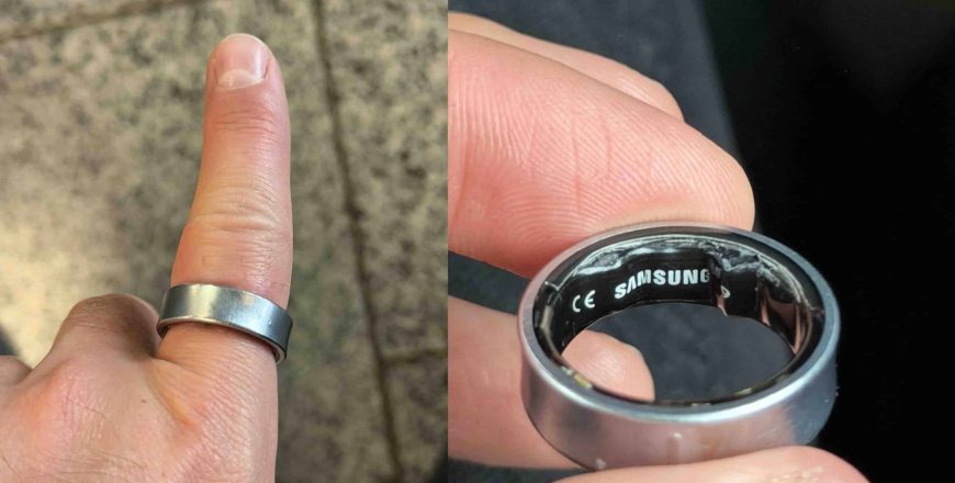 ເກືອບໄດ້ຕັດນິ້ວ! Galaxy Ring ແບັດບວມຕິດນິ້ວ ຕ້ອງຮີບເຂົ້າຫ້ອງສຸກເສີນ ເກືອບໄດ້ຕັດນິ້ວ! Galaxy Ring ແບັດບວມຕິດນິ້ວ ຕ້ອງຮີບເຂົ້າຫ້ອງສຸກເສີນ